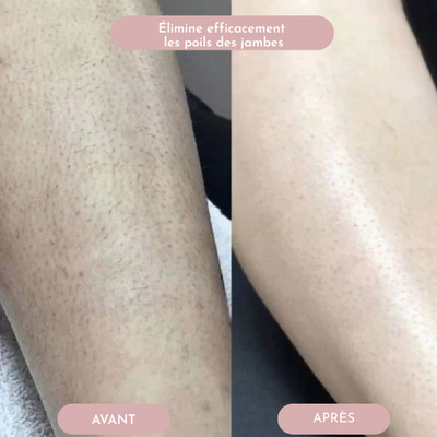 Lissea - Rasage intime sans irritation