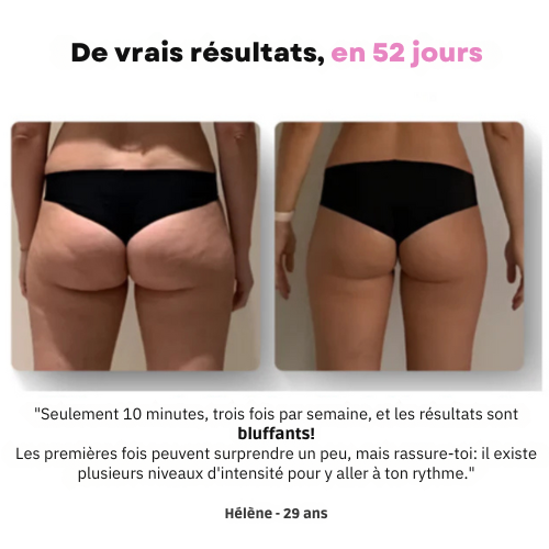 Ventooz -Ventouse Anti-cellulite
