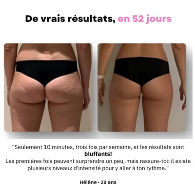Ventooz -Ventouse Anti-cellulite