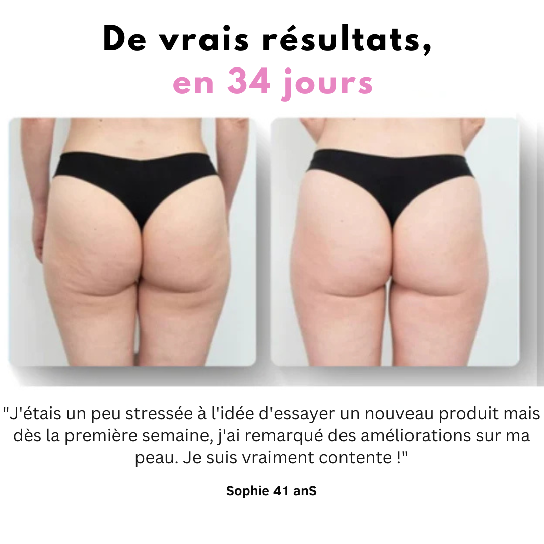 Ventooz -Ventouse Anti-cellulite